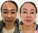577 YUXINTANG - Spray que Remove manchas de SOL, IDADE E MELASMA! 50% DE DESCONTO + FRETE GRÁTIS!