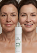 Spray 577 que Remove manchas de SOL, SARDAS, RUGAS e IDADE! 50% DE DESCONTO + FRETE GRÁTIS!