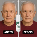 577 YUXINTANG - Spray que Remove manchas de SOL, IDADE E MELASMA! 50% DE DESCONTO + FRETE GRÁTIS!