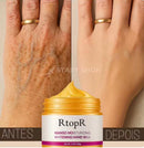 RtopR Removedor de manchas para as Mãos - 50% DE DESCONTO + FRETE GRÁTIS